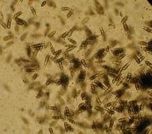 Image related to Arborvitae (Thuja occidentalis)-Tip Blight