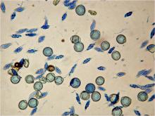 asci with ascospores of Anisogramma anomala