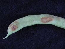 Image related to Bean, Snap (Phaseolus vulgaris)-Web Blight