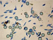 Image related to Fungicide and Pollen Interactions