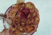 Image related to Garlic (Allium sativum)-Basal Rot