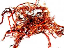 Image related to Kiwifruit (Actinidia spp.)-Root and Crown Rot