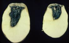 Image related to Potato (Solanum tuberosum)-Bacterial Soft Rot, Blackleg and Lenticel Rot