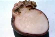 Image related to Potato (Solanum tuberosum)-Potato Wart