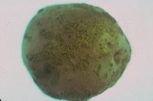 Image related to Potato (Solanum tuberosum)-Scab, Common