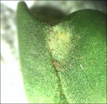 Image related to Rapeseed = Canola (Brassica napus and B. rapa = B. campestris)-Black Leg (Phoma Stem Canker)