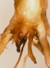 Image related to Wheat (Triticum aestivum)-Rhizoctonia Root Rot (Bare Patch)